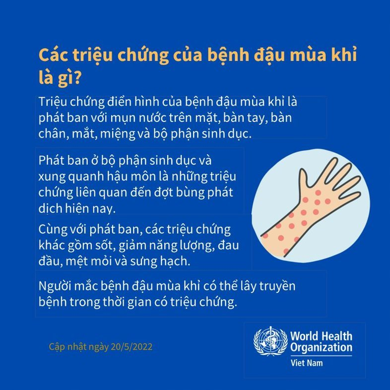 Những thông tin quan trọng về bệnh đậu mùa khỉ